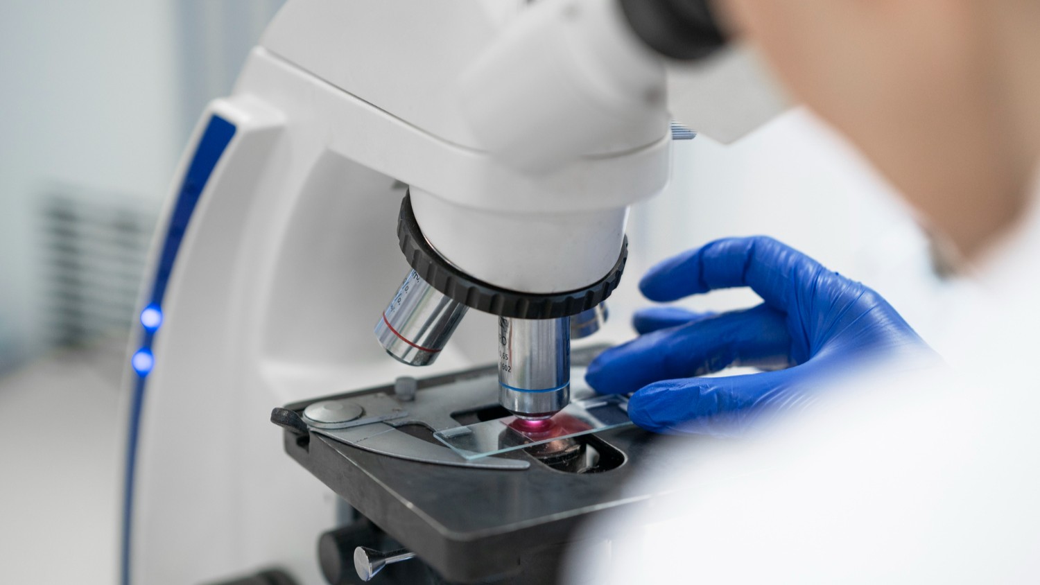 Pathology and Laboratory Automation